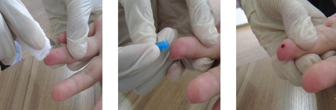 血痕采样 血痕采样