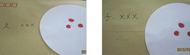 血痕采样 血痕采样